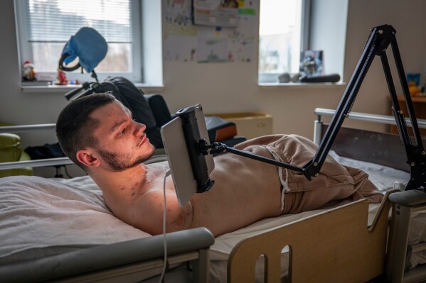 Ruslan Knysh, 20, a war veteran, looks at a tablet, after losing his arms and legs in a drone attack last year, in a hospital bed in Kyiv, Ukraine, Sunday, Feb. 22, 2026. (AP Photo/Dan Bashakov)