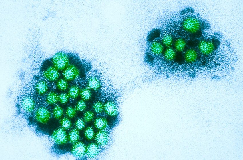  Norovirus outbreak forces North Texas middle school to shut down