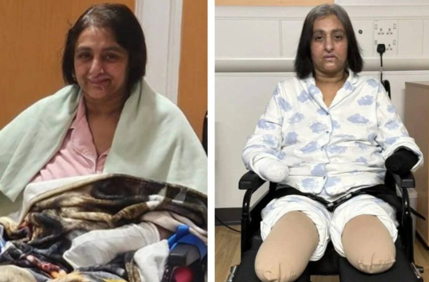  Indian-origin woman in England loses all four limbs after dog lick leads to sepsis: ‘How did this happen in 24 hours?’
