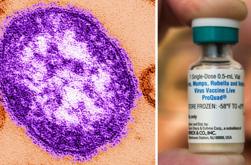  Potential measles exposure identified at several Wake County locations