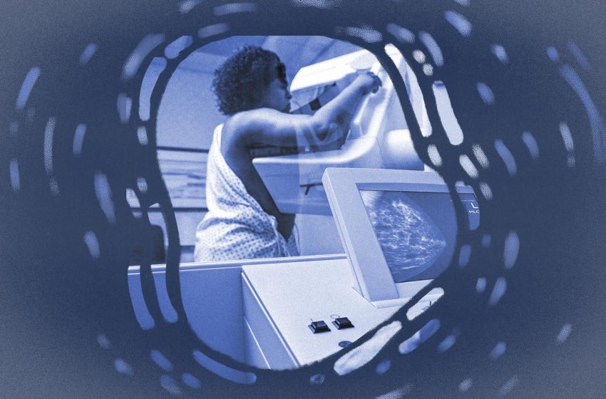  Breast cancer detection depends on mammograms. They don’t work for women like me.
