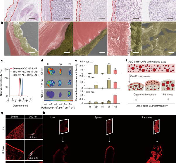  Pancreatic-targeted lipid nanoparticles based on organ capsule filtration