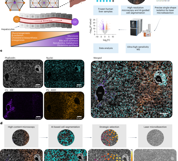  Single-cell spatial proteomics maps human liver zonation patterns and their vulnerability to disruption in tissue architecture