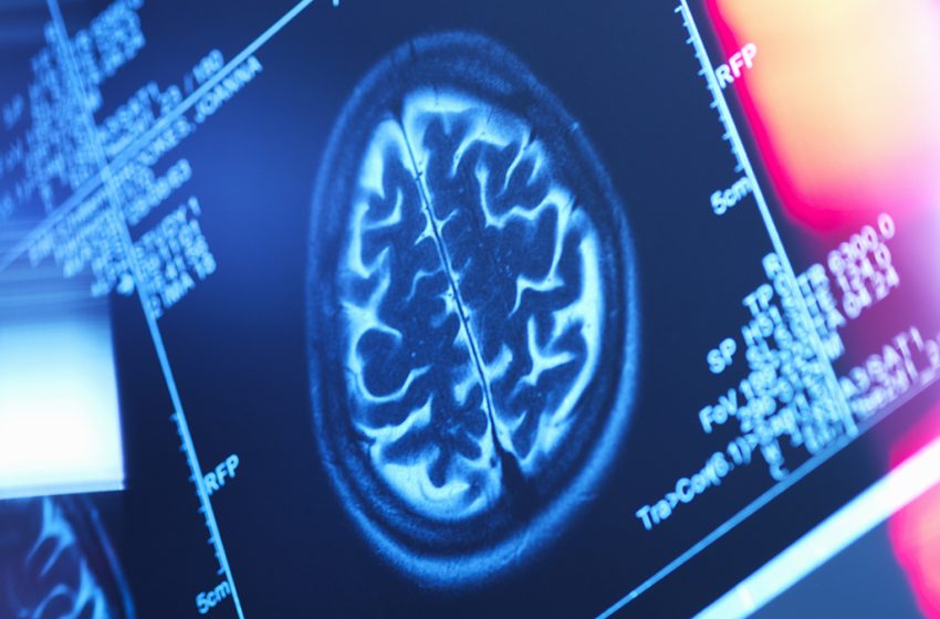  Hidden Patterns of Body Fat Could Be Shrinking Your Brain, Study Finds : ScienceAlert