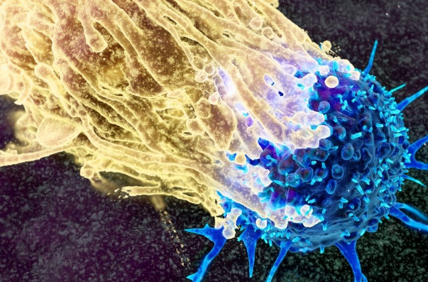  Scientists Want to Intercept Cancer Decades Before It Develops. Here’s How. : ScienceAlert
