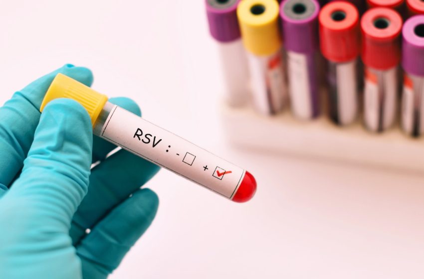  RSV is spreading in N.J. See which counties have the highest levels.
