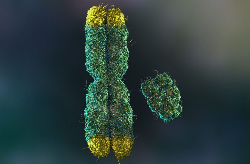  Many men lose their Y chromosomes as they age. It may shorten their lives.