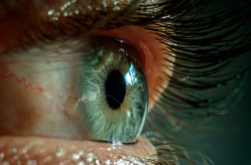  Bad sleep made woman’s eyelids so floppy they flipped inside out, got stuck