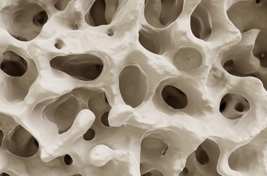  Breakthrough Study Reveals The Secret of How Exercise Fights Osteoporosis : ScienceAlert