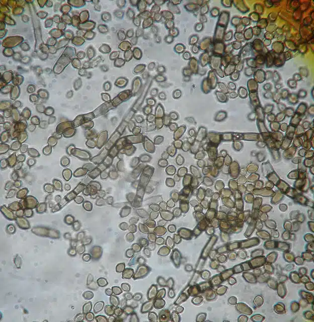 Inside Cladosporium Sphaerospermum A Closer Look Under The Microscope