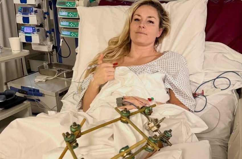  Lindsey Vonn says surgery saved her leg from amputation after Olympics crash