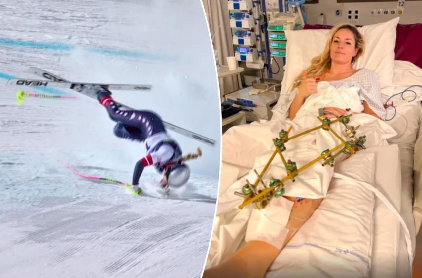  Lindsey Vonn set for ‘further surgeries’ after flying back to US