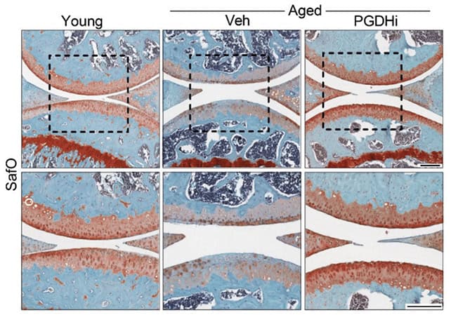 Delaying brain aging with PGDHi shown in research images of cortical tissues.