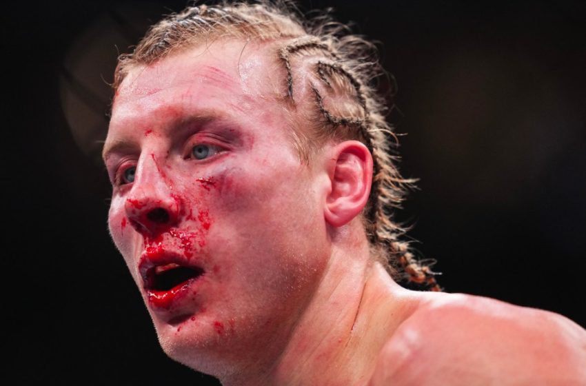  Paddy Pimblett reflects on brutal Justin Gaethje loss: ‘He made my face look different’