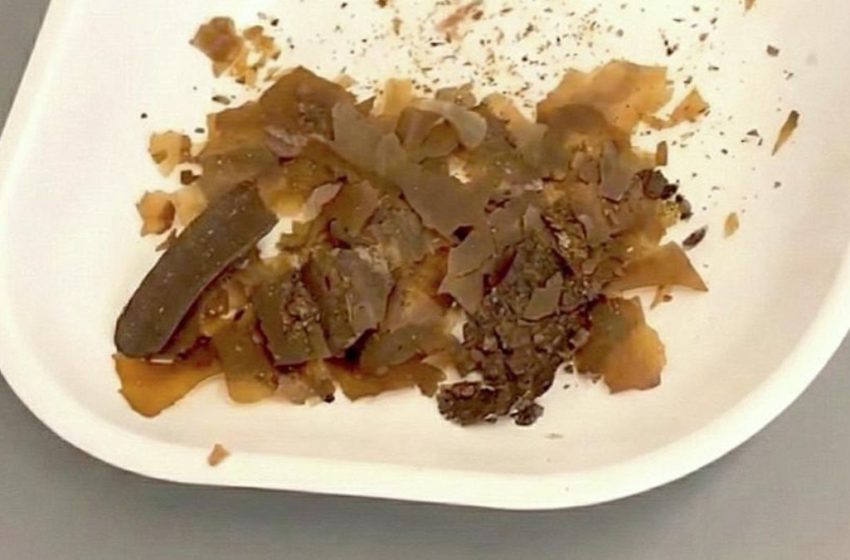  Ancient Romans Really Did Use Poop as Medicine. We Just Got The First Real Proof. : ScienceAlert