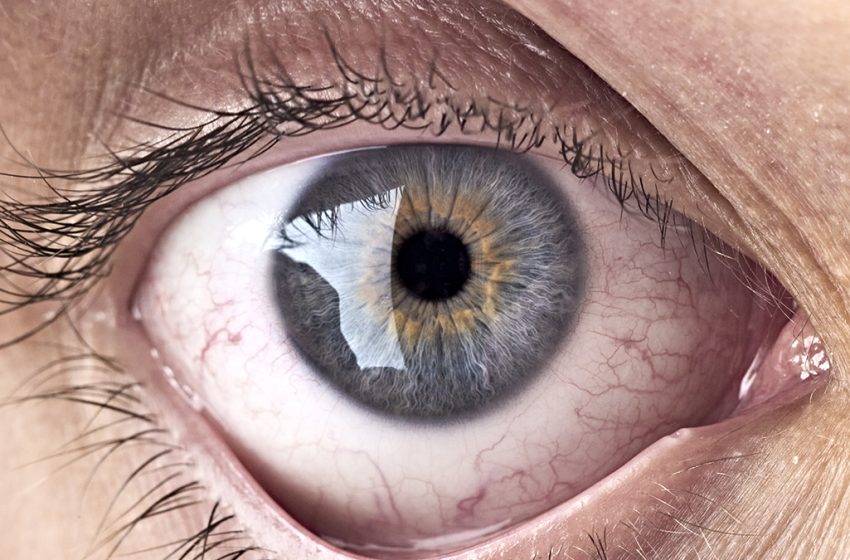  Bacteria at The Back of Your Eye May Be Linked With Alzheimer’s Progress : ScienceAlert