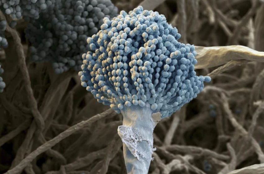  A Deadly Fungus That “Eats Human Body from Within” Is Spreading Rapidly Across the Planet