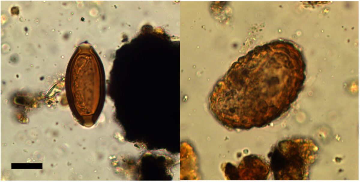 Trichuris Sp. (left) And Ascaris Sp