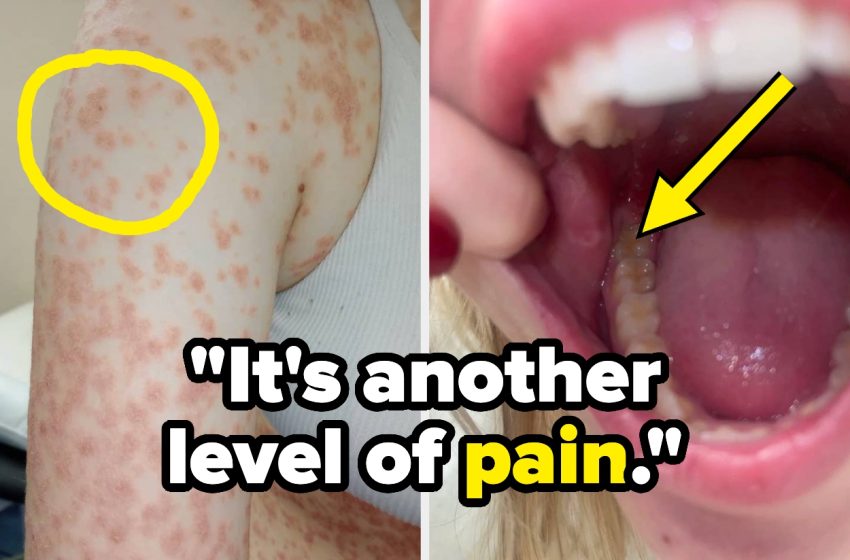  21 Hard Truths About Living With “Minor” Medical Issues