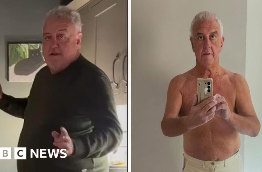  Mounjaro availability a postcode lottery, says Stone patient – BBC