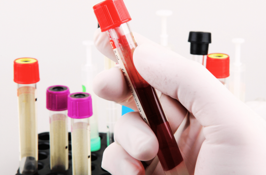  After 50 Years, Scientists Discover a New Blood Group That Changes Transfusion Medicine