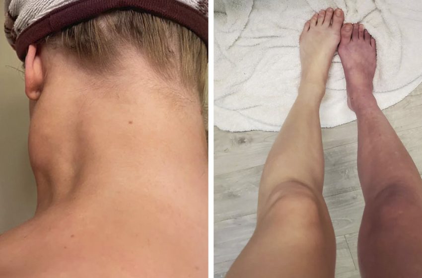  “Nearly Cost Me My Life”: 82 Body Clues That Mean You Should See A Doctor ASAP