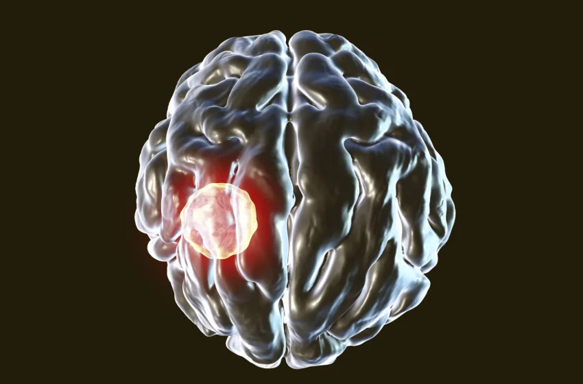  One in three people carry this brain parasite but the body has a kill switch