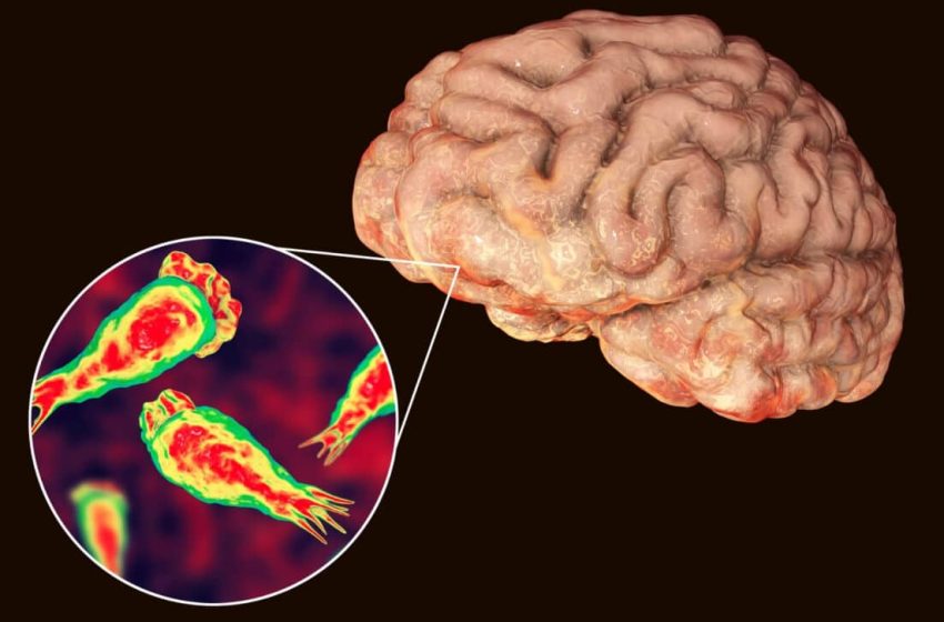  This Deadly Amoeba Could Destroy Your Brain, and It’s Lurking in Your Water