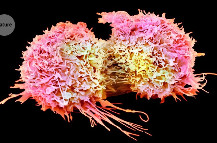  How tumours trick the brain into shutting down cancer-fighting cells