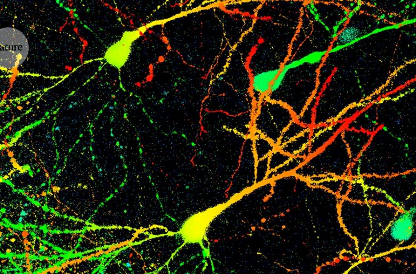  Exercise rewires the brain — boosting the body’s endurance