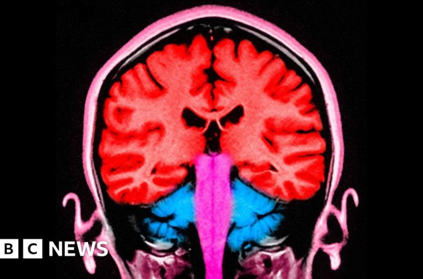  Brain stimulating test makes people 'less selfish' – BBC