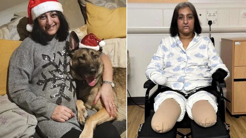  A routine dog lick, 2 days later Punjabi-origin woman in UK was in coma, all limbs removed