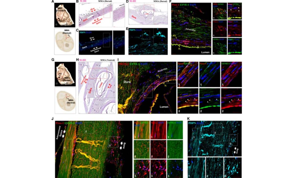 Immunofluorescence Microscopy Reveals Lymphatic Structures In The Dorsal And Ventral Segments Of The Human Mma. ©iscience