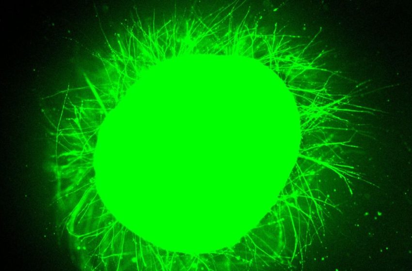  Scientists Grew Mini Human Spinal Cords, Then Made Them Repair After Injury : ScienceAlert