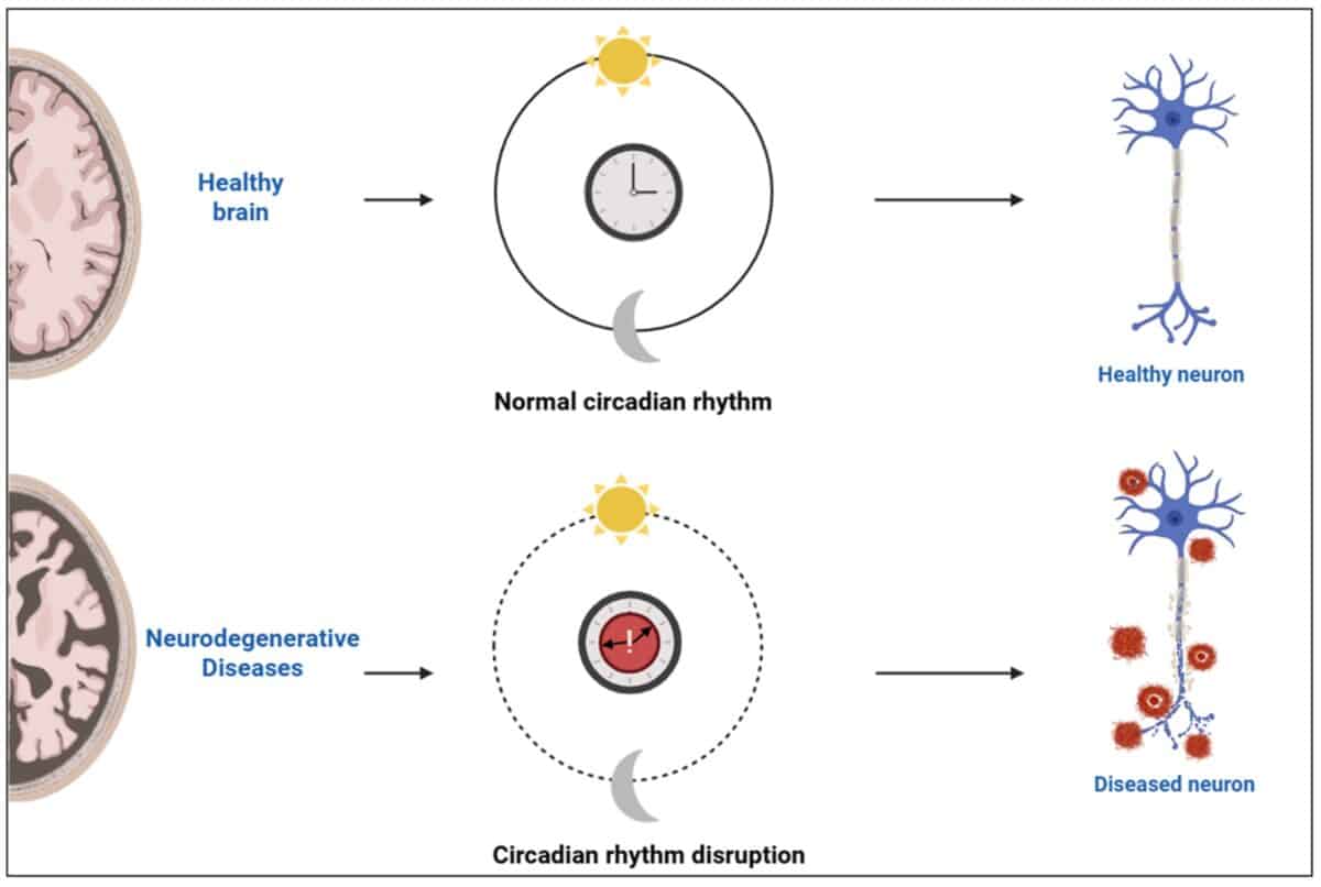 Schematic Representation Of Circadian Rhythm Integrity And Its Impact On Neuronal Health