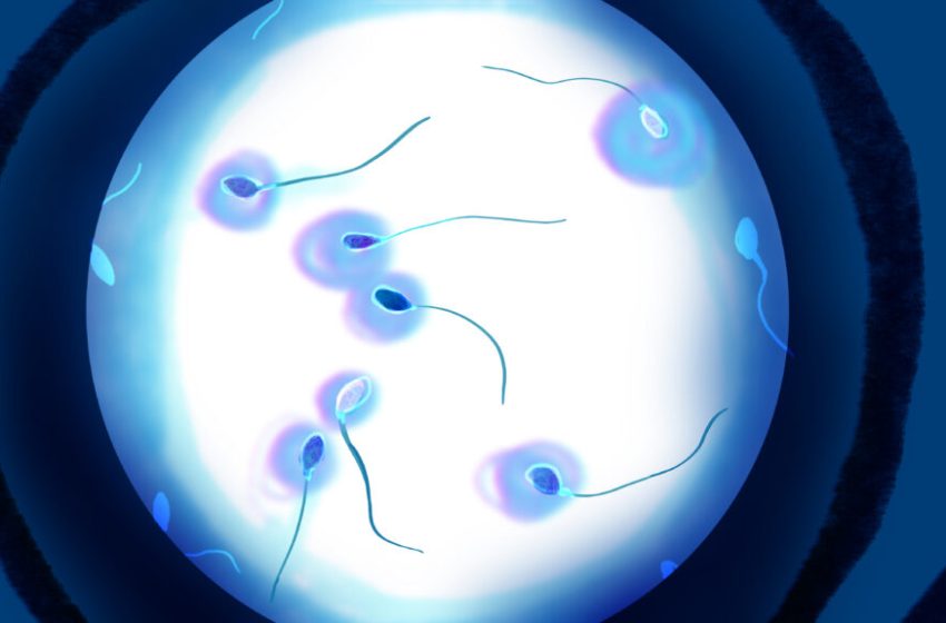  A ‘guy-necologist’? Startups push semen analysis as male Pap smears