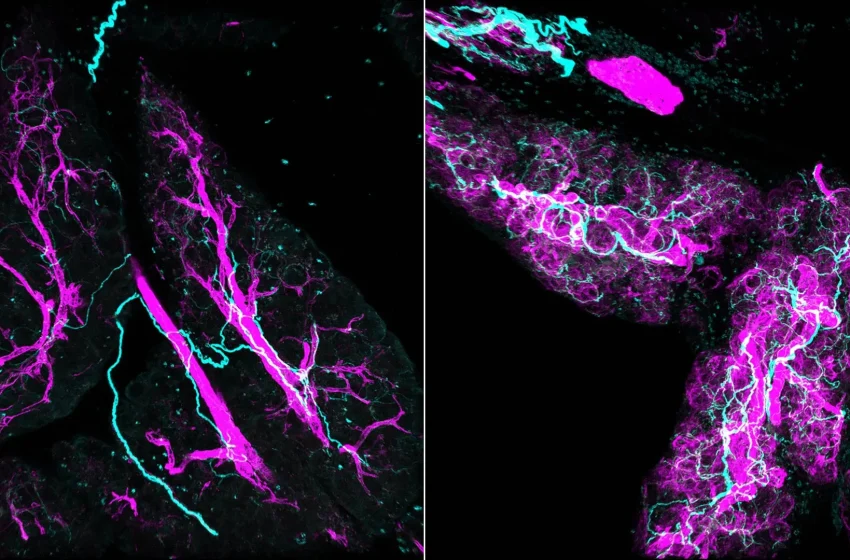  Scientists find nerves actively fuel pancreatic cancer