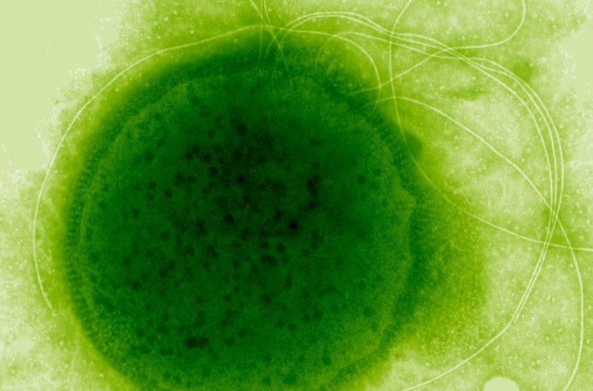  This Extreme Radiation-Resistant Organism Evolved a Remarkable Ability : ScienceAlert