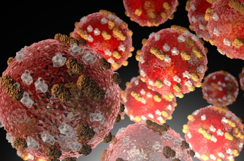  Possible measles exposure at St. Louis airport, Collinsville church