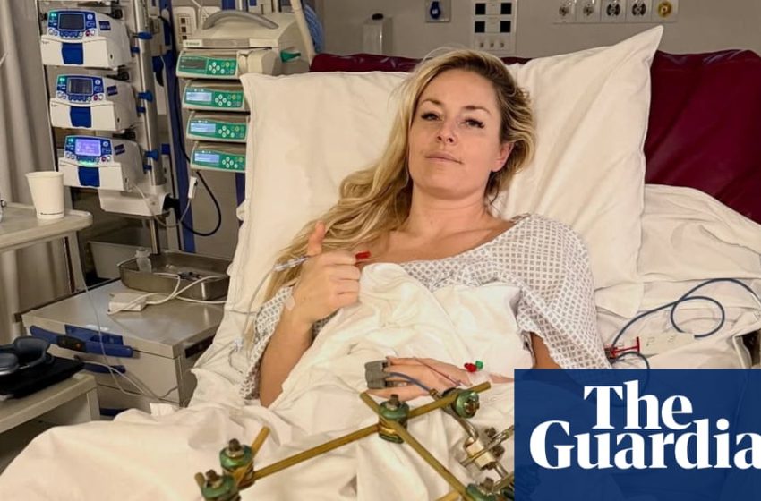  ‘Long, long way to go’: Lindsey Vonn says she’ll have fourth surgery on broken leg | Lindsey Vonn