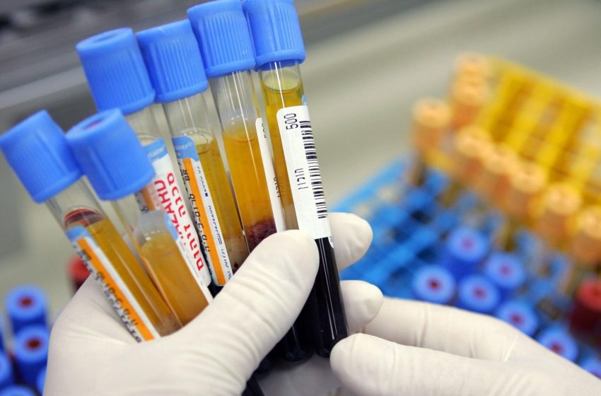  Simple Blood Test Can Predict Dementia 25 Years in Advance, Study Suggests