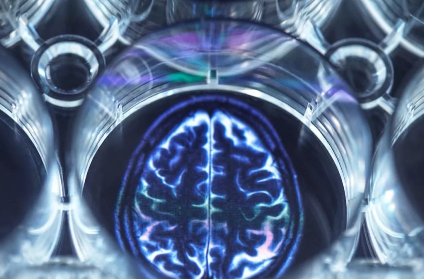  Scientists Are Trying to Train Lab-Grown Brains. The Brains Have Started to Solve Problems.