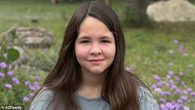  Girl, 13, loses three of her four limbs after coming down with flu