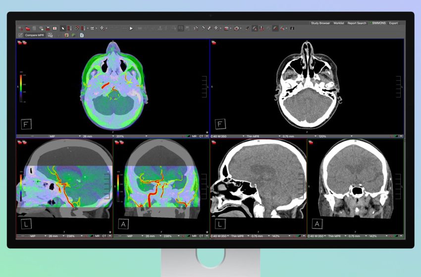  Apple’s Studio Display XDR Supports DICOM Medical Imaging for Diagnostic Radiology