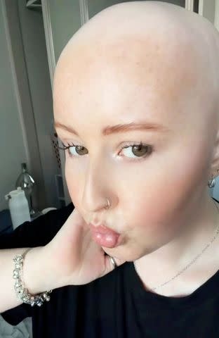 Emma Herring during chemotherapyCredit: Emma Herring/SWNS