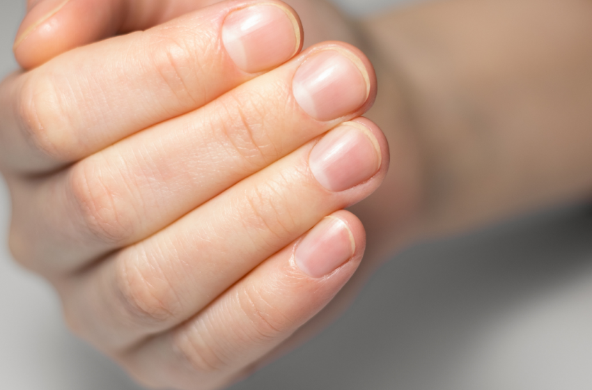  Doctors say your nails may reveal hidden health problems