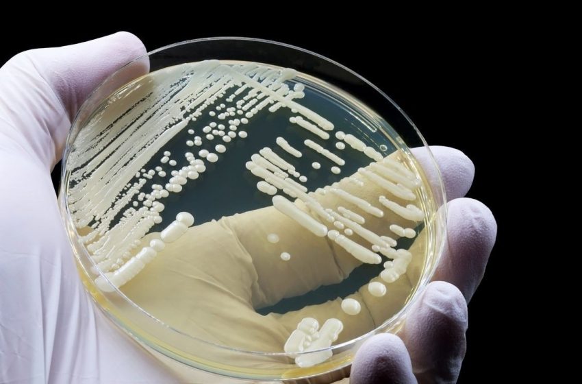  Experts point to cause behind Candida Auris spike in Tennessee