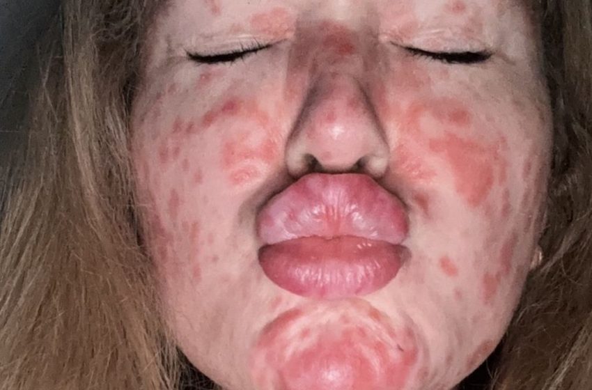  ‘I caught a Victorian disease that made people avoid me – and fell pregnant’