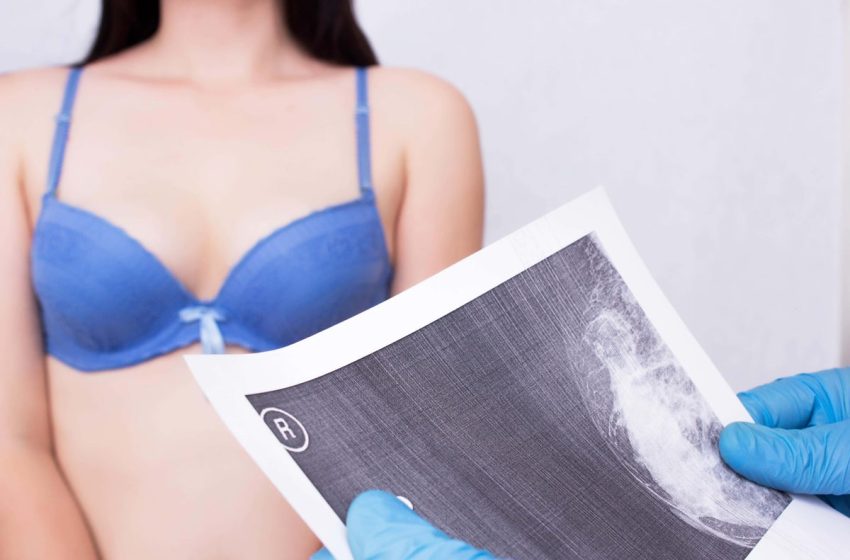  Common dental problem linked to breast cancer by new study