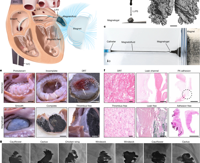  Long-term thrombus-free left atrial appendage occlusion via magnetofluids